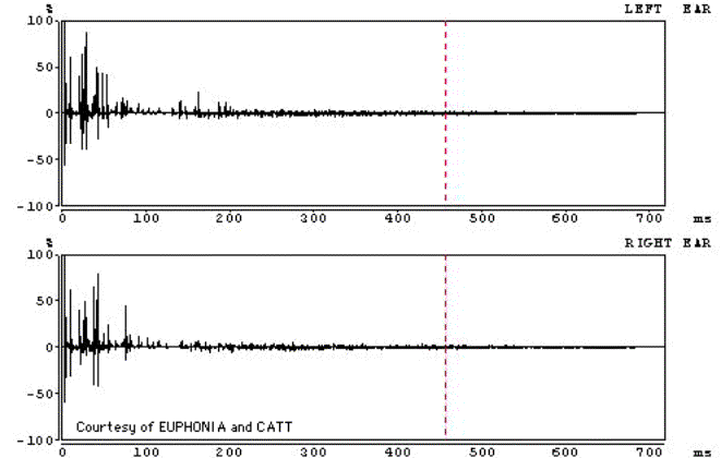 Binaural impulse response